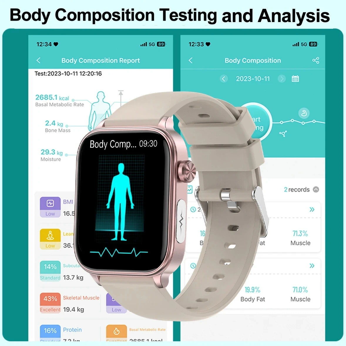 Relógio Smartwatch Diagnostico IA, lipidios, acido urico, glcose, ECG + PPG, voz, Bluetooth